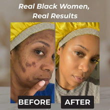 Load image into Gallery viewer, Rennora Dark Spot Remover