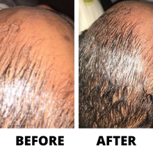Load image into Gallery viewer, Get Three Bottles of Rennora EXTRA-Strength Hair Growth Serum